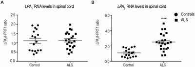Dual Role of Lysophosphatidic Acid Receptor 2 (LPA2) in Amyotrophic Lateral Sclerosis